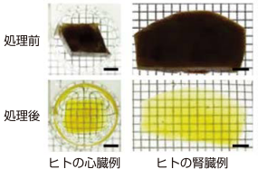 CUBICにより透明化されたヒト組織